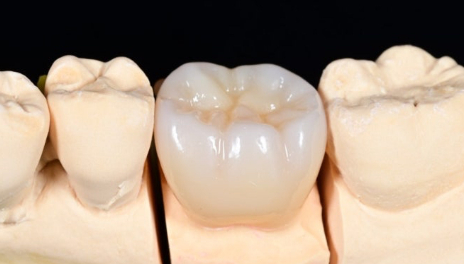 Zirconia